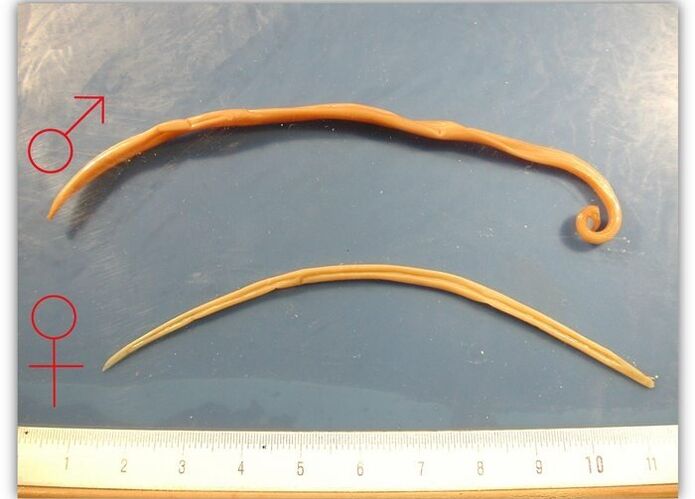 The size of the roundworms that affect the respiratory tract of adults